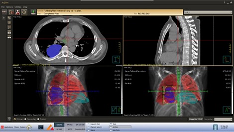 Phillips Pinnacle³ ACQSIM³