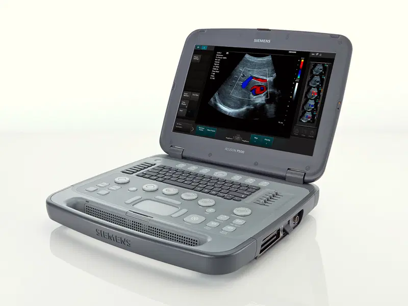 Портативная ультразвуковая  система Siemens ACUSON P500