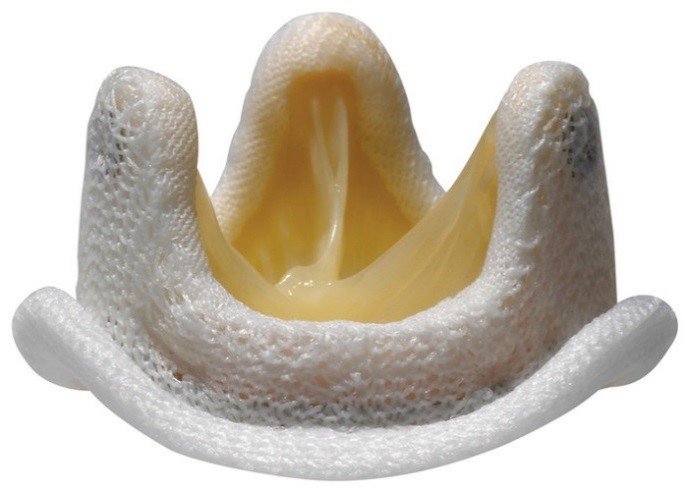 Протез клапана сердца биологический Medtronic Hancock II 