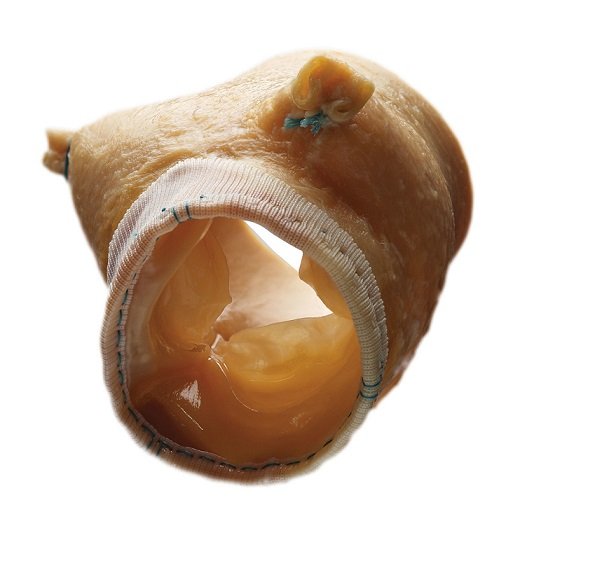 Биопротез аортального клапана Medtronic Freestyle 