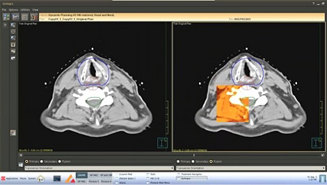 Система окунтуривания Phillips Pinnacle³ Syntegra 