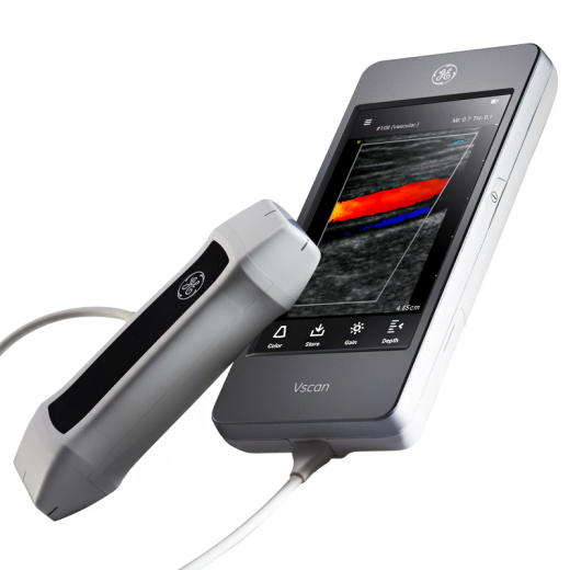 Ручная ультразвуковая система GE Vscan Extend