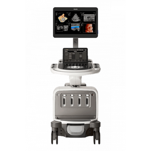 Премиальная ультразвуковая система Philips EPIQ Elite